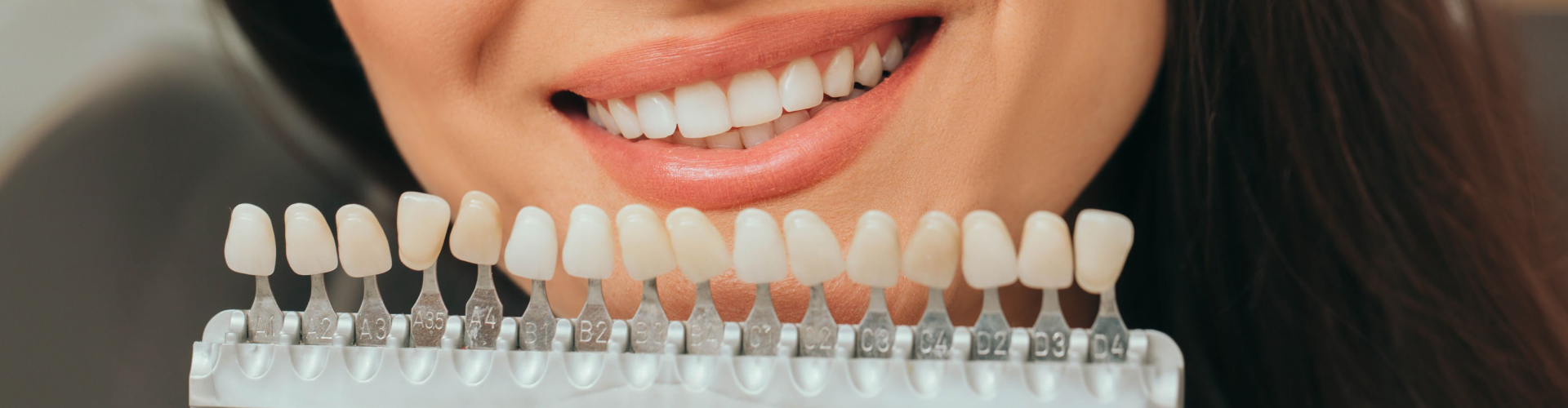 Patient smiling while holding a dental shade guide used to match tooth color for veneers, crowns, or teeth whitening treatment.